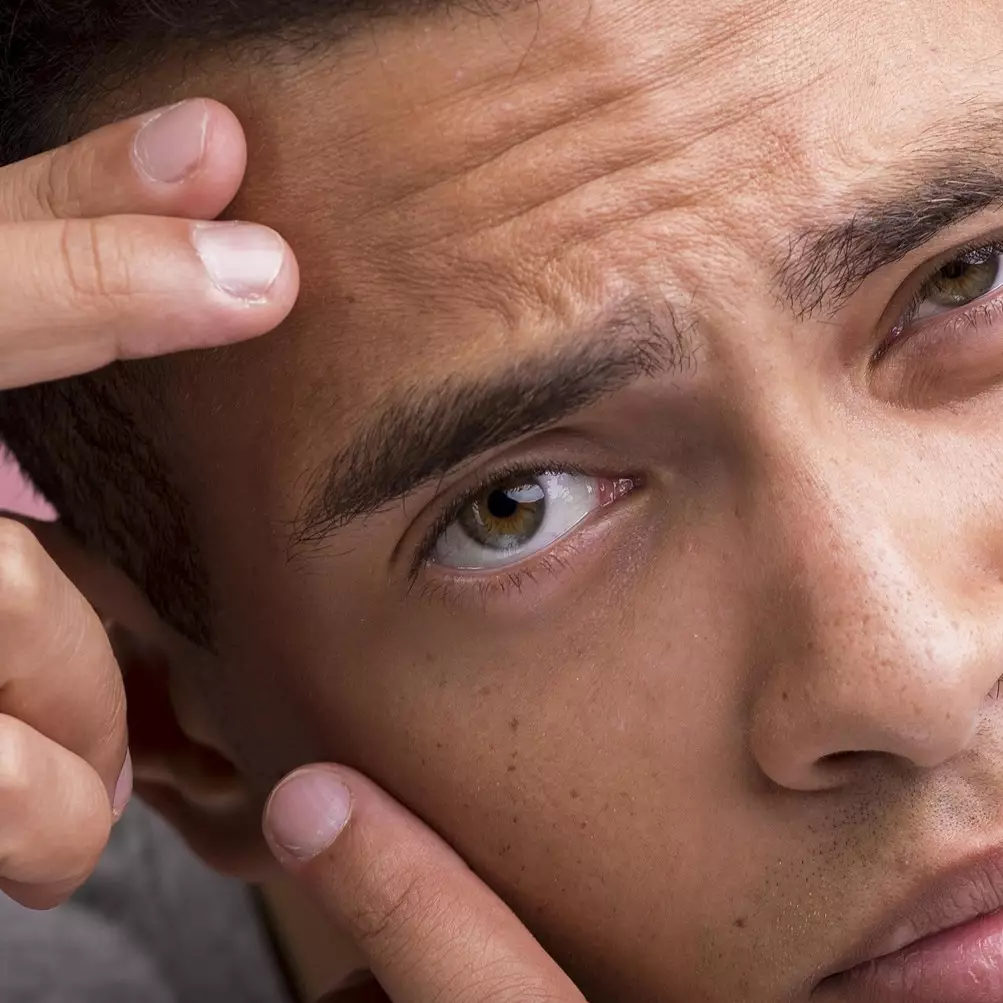 Bukan gunakan tomat, ini trik mencegah penuaan dini agar tak muncul garis halus pakai 1 jenis kacang