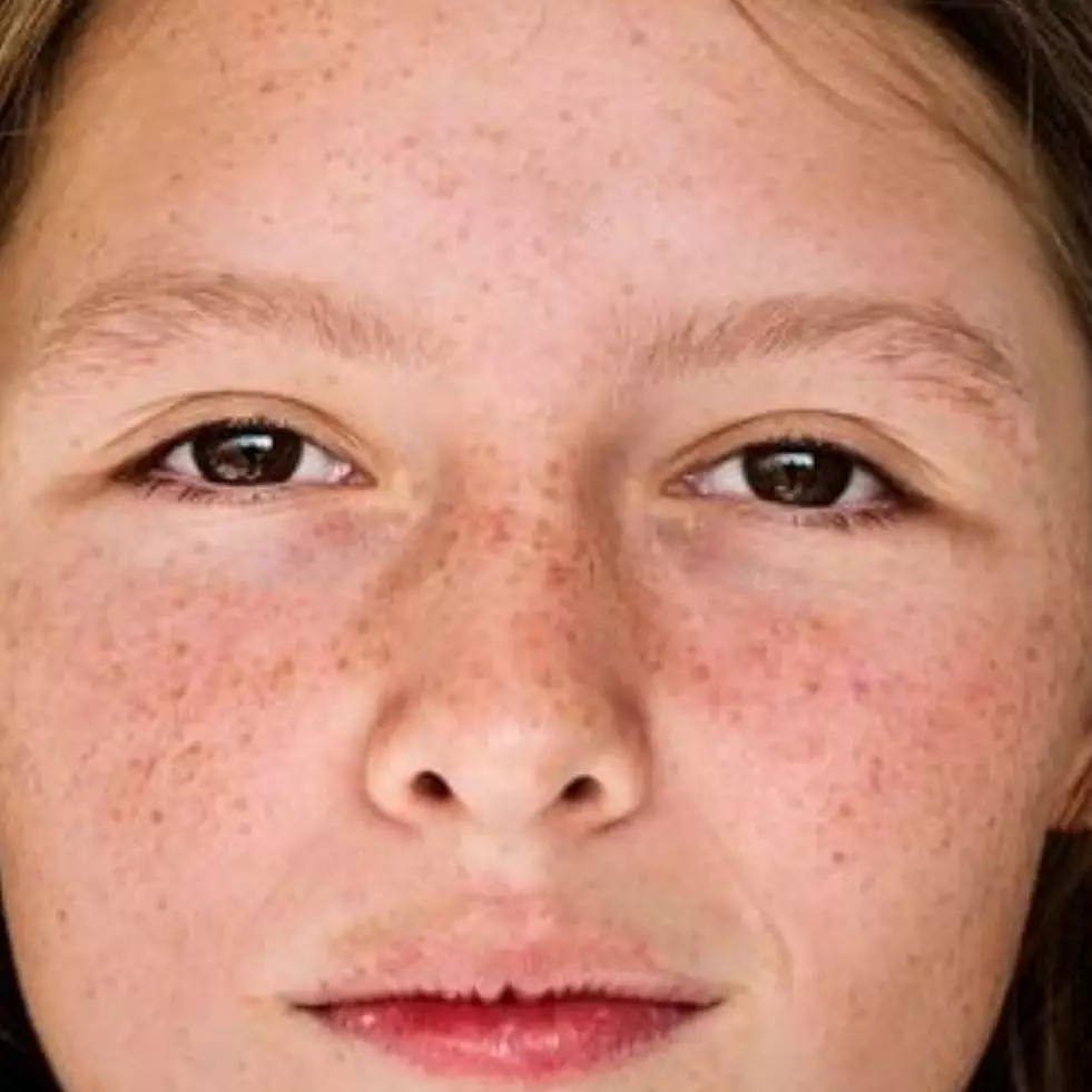 Cara memudarkan flek hitam di wajah pakai krim dari 1 bumbu dapur ini bikin kulit auto glow up