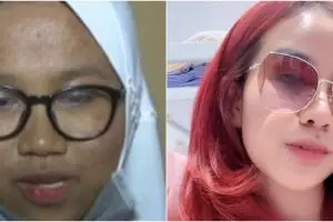 Habiskan biaya perawatan hingga Rp 80 juta, 9 potret dulu dan kini Mayang ini bak beda orang