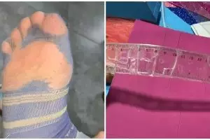 17 Potret kocak barang rusak masih dipakai ini bikin gagal paham, irit dan pelit beda tipis