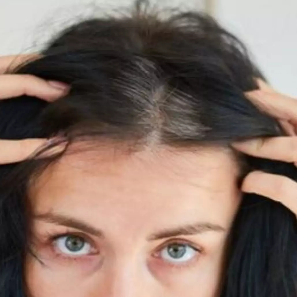 Hitam merata tanpa semir, begini cara cegah tumbuhnya uban prematur pakai 1 produk bayi