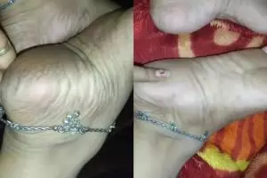 Halus dalam 1 kali pemakaian, ini trik atasi tumit kaki hitam yang kering & retak pakai 1 bahan dapur