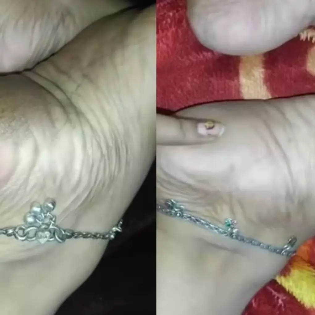 Halus dalam 1 kali pemakaian, ini trik atasi tumit kaki hitam yang kering &amp; retak pakai 1 bahan dapur