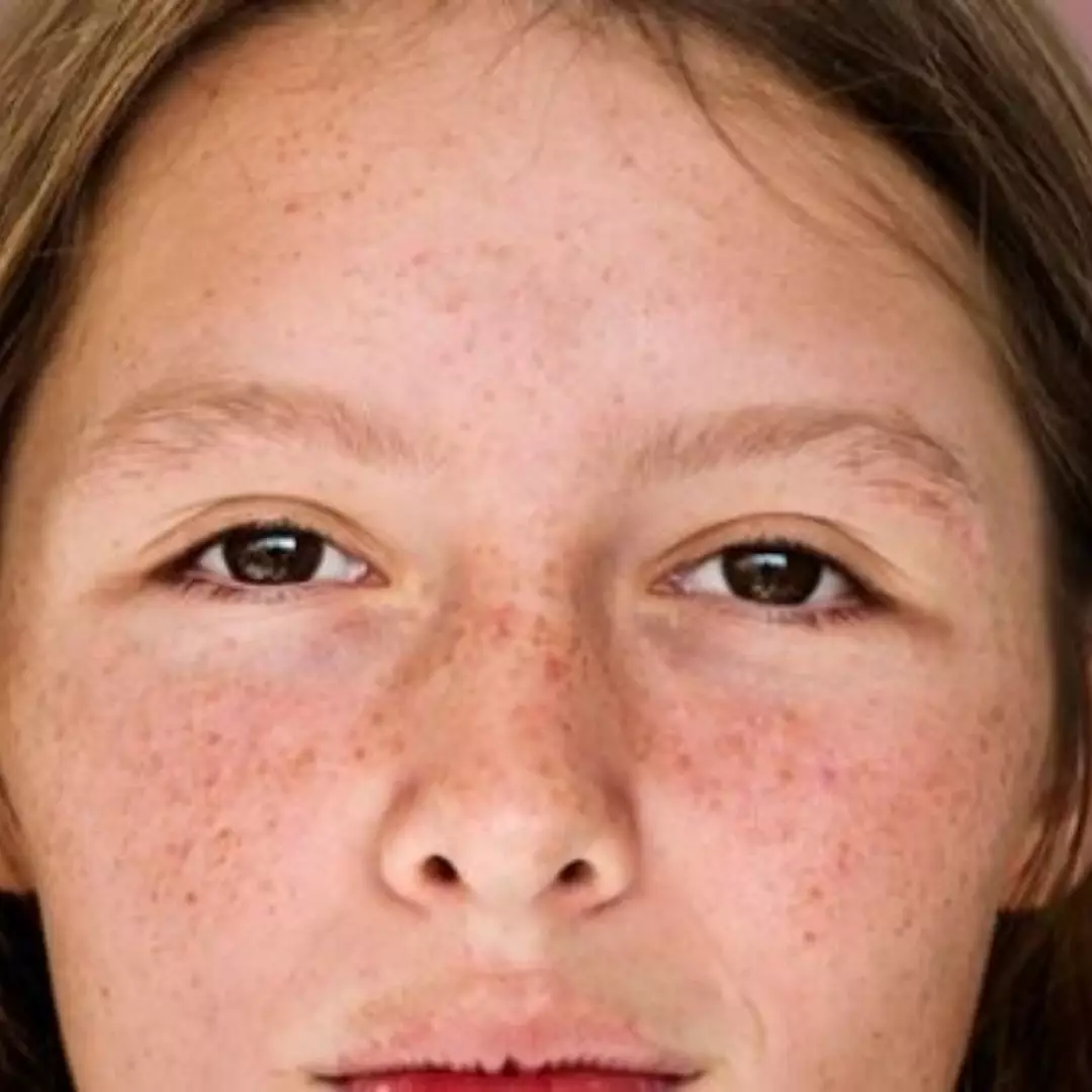 Wajah mulus tanpa laser mahal, ini trik pudarkan flek hitam cuma pakai 1 jenis tanaman herbal