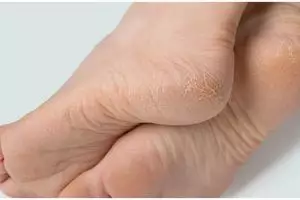 Tanpa direndam air garam, ini trik atasi tumit kaki pecah-pecah pakai 1 alat pembersih gigi