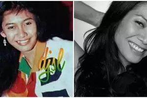 Habiskan puluhan juta buat gigi, potret dulu dan kini 6 seleb usai cabut gingsul ini bikin fans kecewa