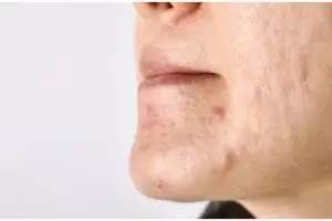 Tak perlu beli produknya, ini cara hempaskan radikal bebas di pori-pori pakai face wash dari 1 daun