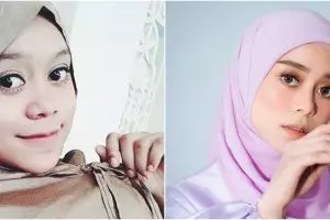 Akui tak jalani operasi plastik, 9 potret Lesty Kejora sebelum dan sesudah perawatan ini manglingi