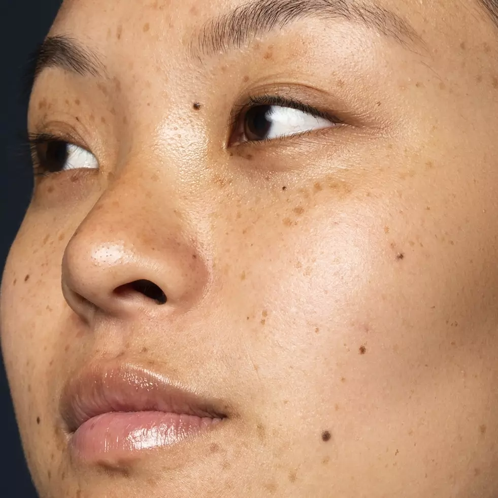 Tanpa campuran lemon, ini trik memudarkan flek hitam akibat penuaan pakai toner dari 1 bunga