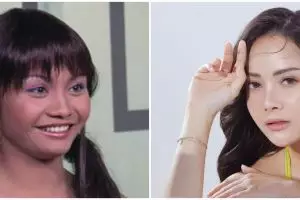 Dipuji bak idol K-pop, 11 potret Mawar AFI sebelum dan sesudah operasi plastik bikin takjub