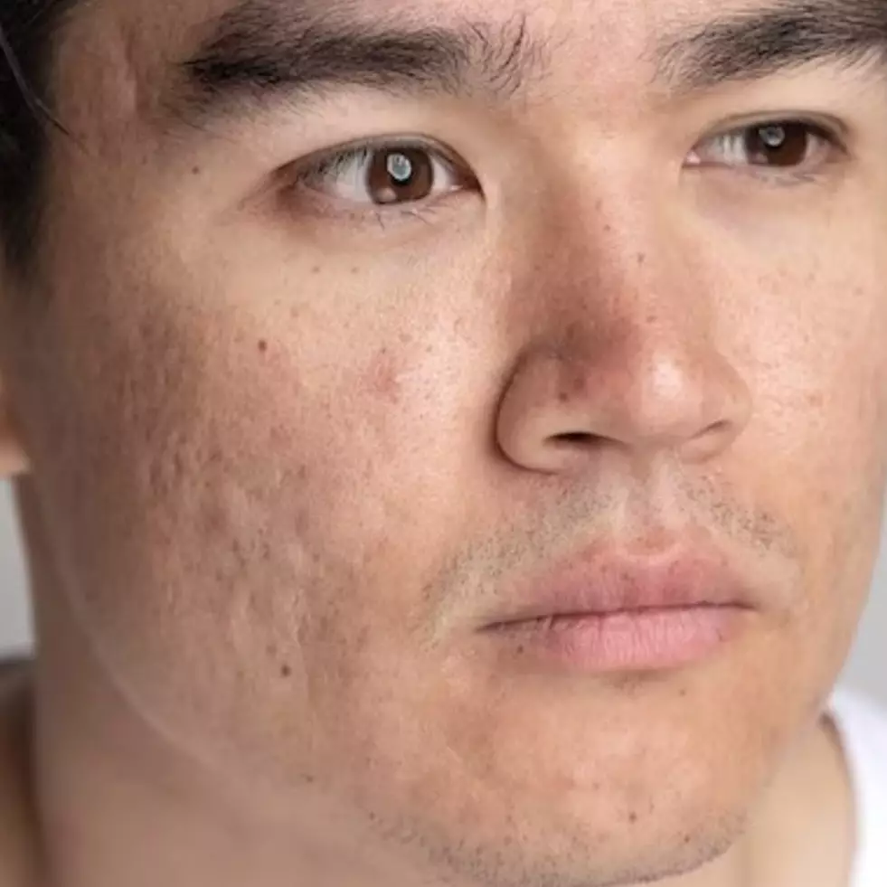 Bukan dengan aloe vera, ini trik simpel muluskan kulit kasar dan penuh daki pakai 1 jenis minuman