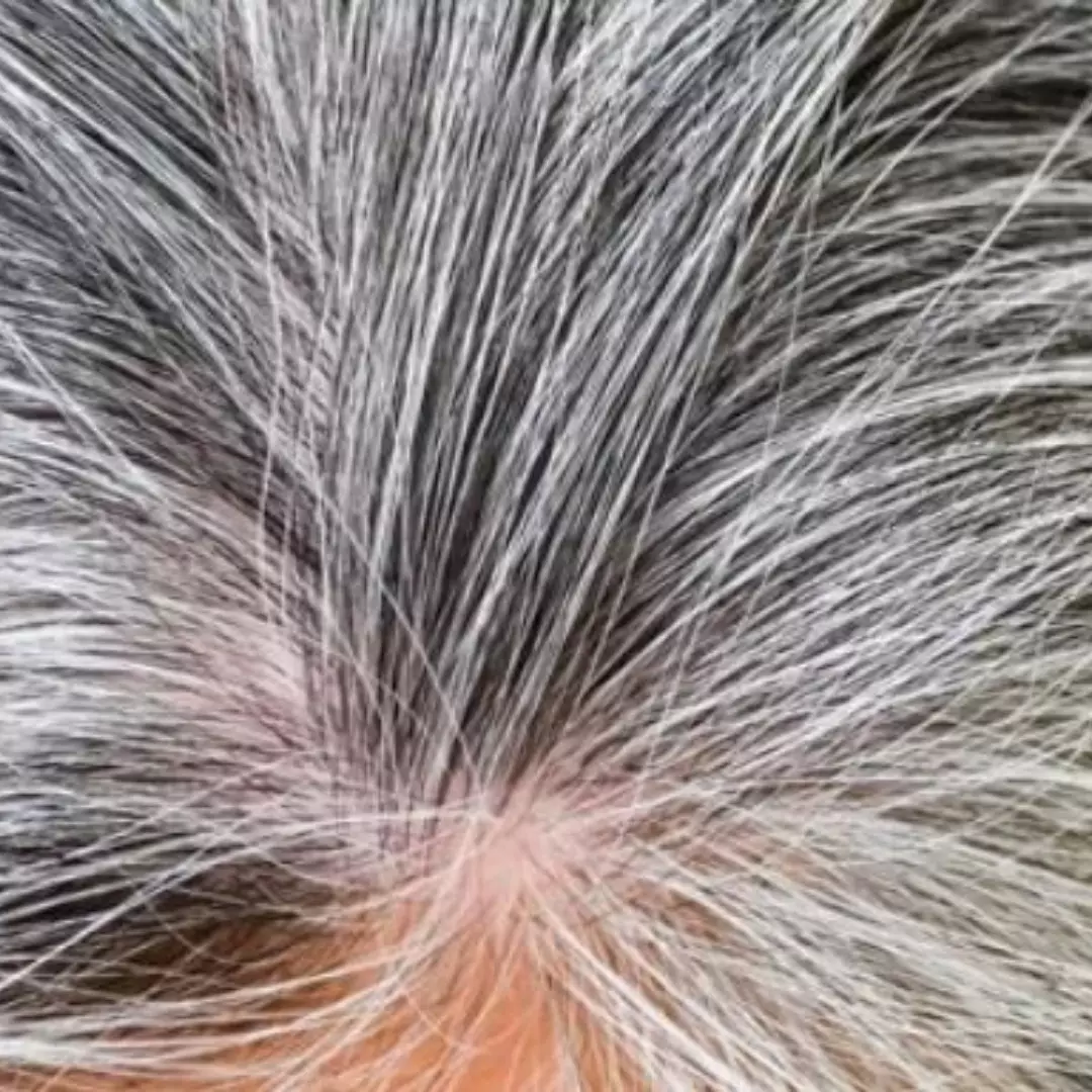 Tak cuma pakai kopi, ini cara cegah rambut uban bertambah banyak pakai tambahan 1 jenis minyak