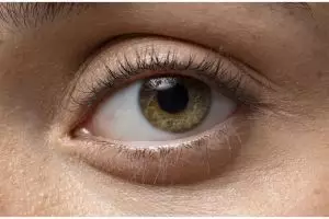 Hasilnya terlihat dalam seminggu, ini trik hilangkan dark circle pakai eye mask dari 1 bahan minuman