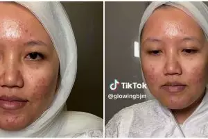 Nggak ada request khusus, pengantin wajah berjerawat di-makeup natural ini cantiknya bak gadis melayu
