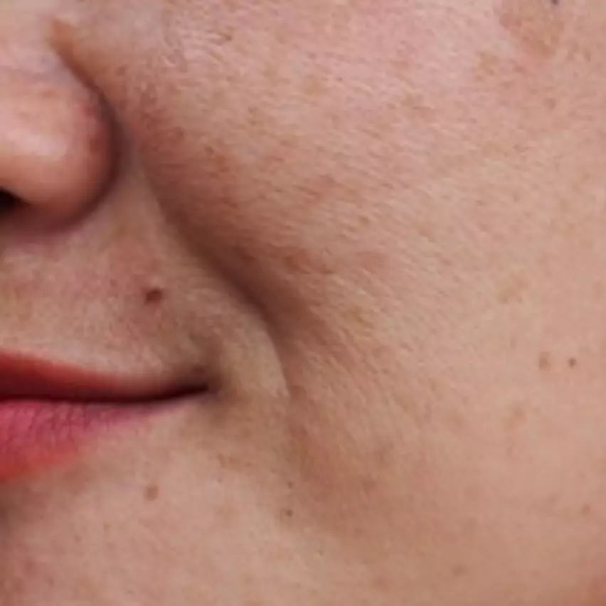 Tak perlu serum pemutih, ini trik enyahkan flek hitam pada kulit kusam pakai 2 jenis tepung