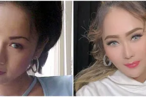 Biaya suntik kecantikan hampir Rp 100 juta, ini 11 transformasi Inul Daratista yang kini kian glowing