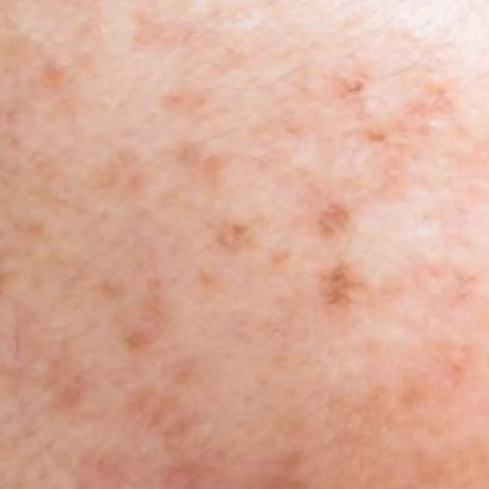 Tanpa tambahan minyak zaitun, ini trik pudarkan flek hitam akibat pigmentasi pakai 1 jenis rempah