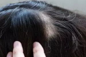 Kembali hitam tanpa semir, ini trik menyamarkan tampilan uban pakai 1 jenis umbi-umbian