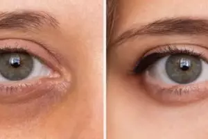 Nggak perlu timun dan kopi, begini trik pudarkan kantung mata hitam cuma pakai 1 jenis buah