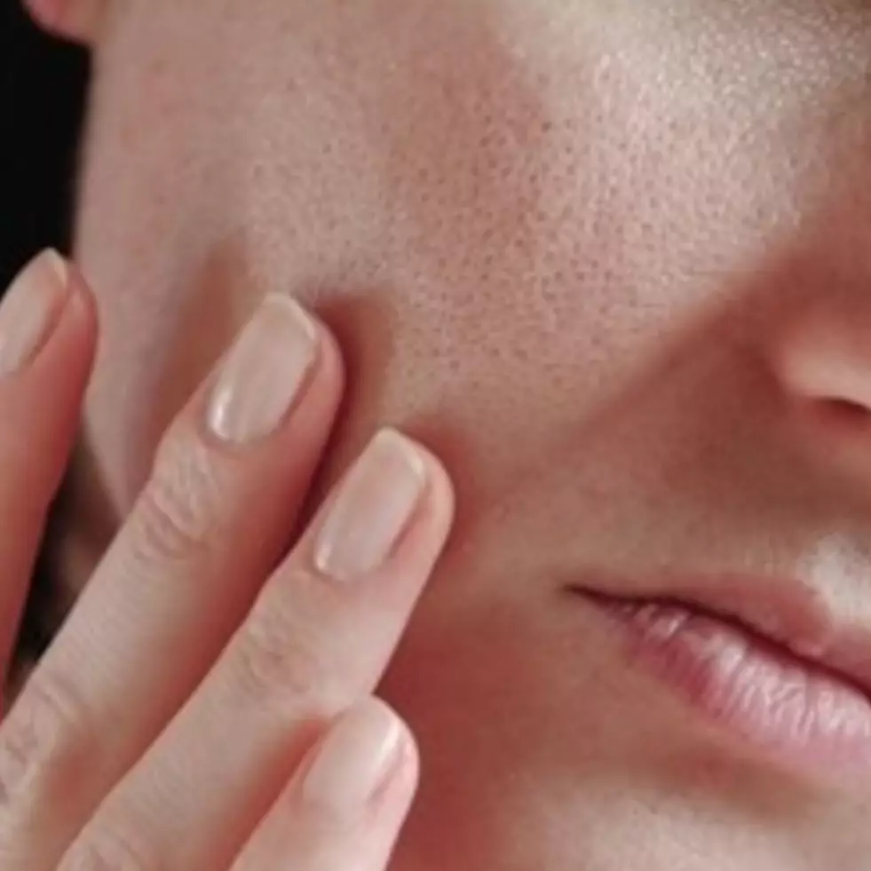 Bukan pakai tomat, ini cara bikin pori-pori wajah rapat dan bebas komedo pakai 2 jenis tanaman