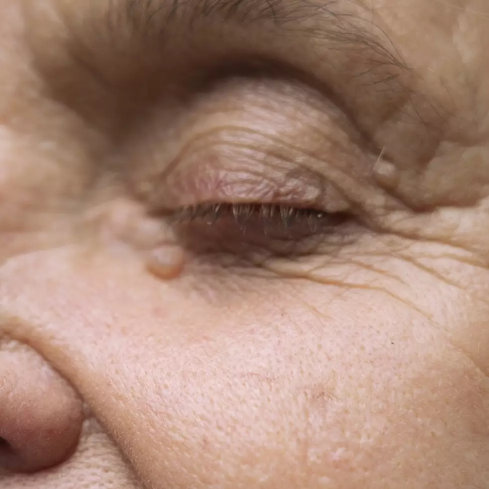 Usia 60 terlihat 15 tahun lebih muda, ini cara kembalikan wajah keriput jadi halus pakai 1 jenis buah