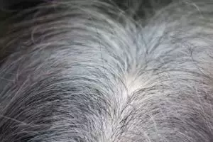 Tanpa kopi dan jintan, begini trik mencegah uban tumbuh semakin banyak pakai 1 jenis buah