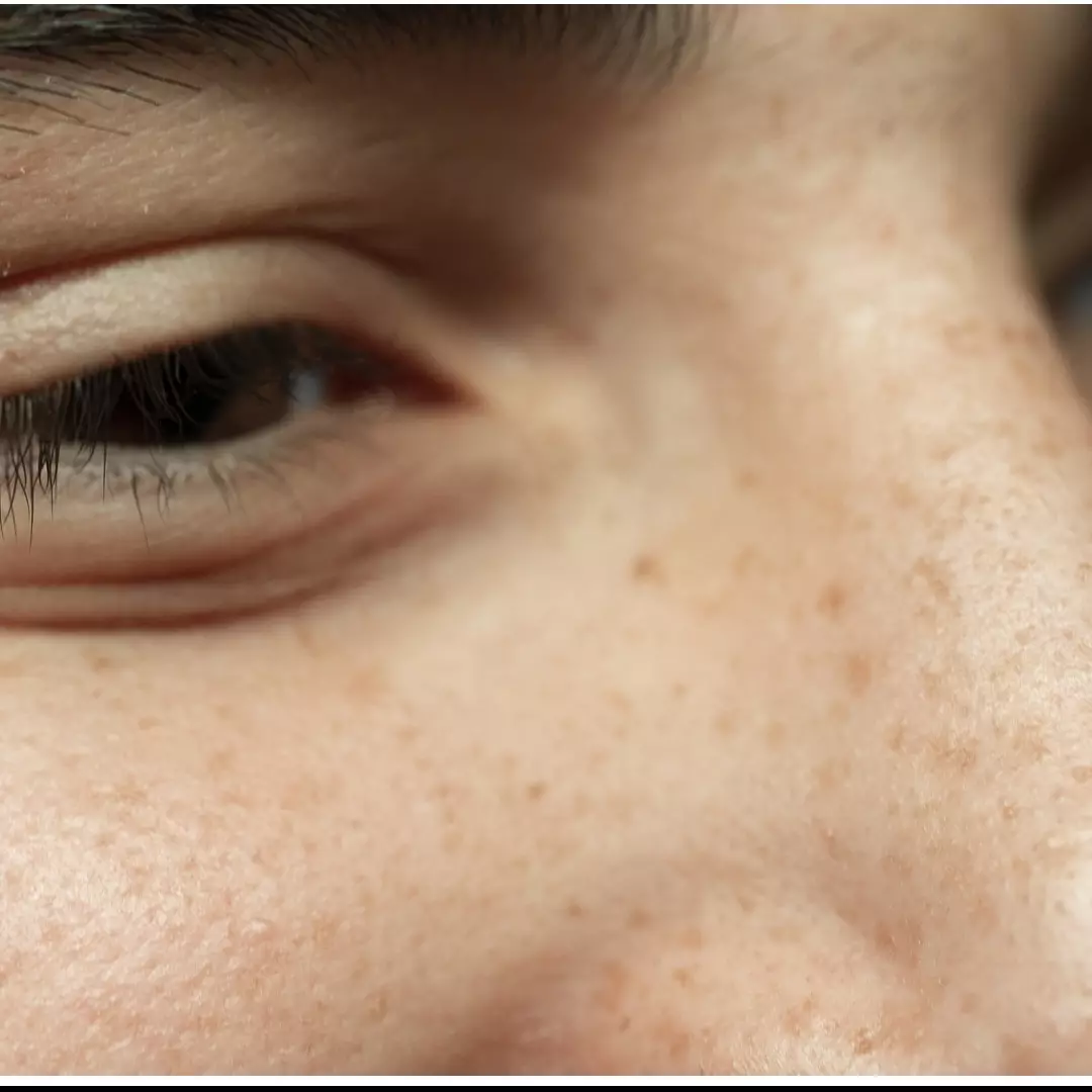 Tanpa treatment laser, ini cara pudarkan pigmentasi akibat penuaan pakai masker dari 1 bahan salad