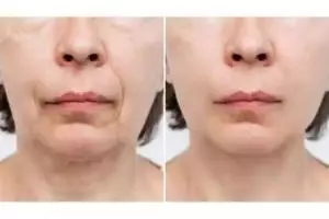 Tanpa putih telur, ini cara bikin kencang wajah kendur agar kembali muda pakai 1 jenis daun penyedap