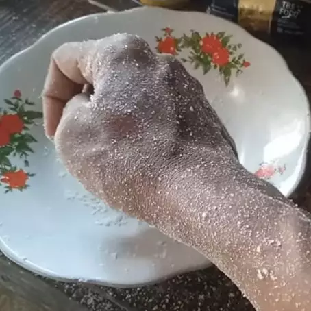 Pakai 1 bumbu dapur, ini cara mengatasi kulit yang tersiram air panas agar tak melepuh dan berbekas