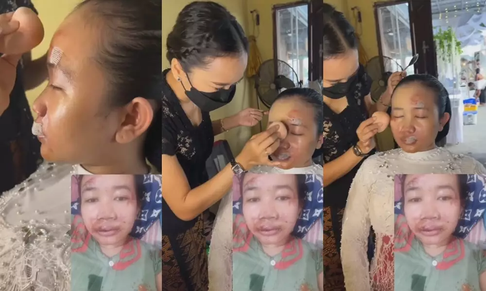 pengantin kecelakaan H-2 dirias apik bikin pangling © 2023 brilio.net