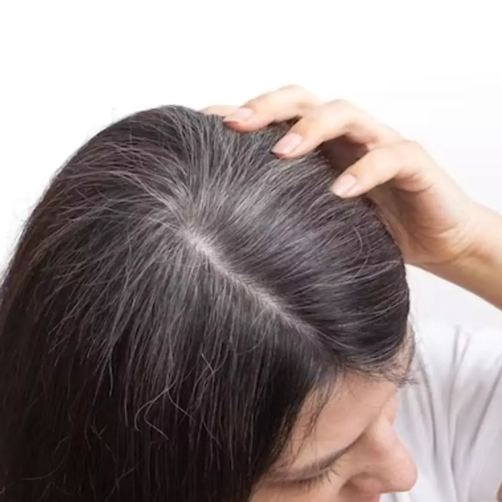 Tanpa minyak jintan, ini trik bikin rambut beruban kembali hitam alami bak disemir pakai 3 bahan dapur