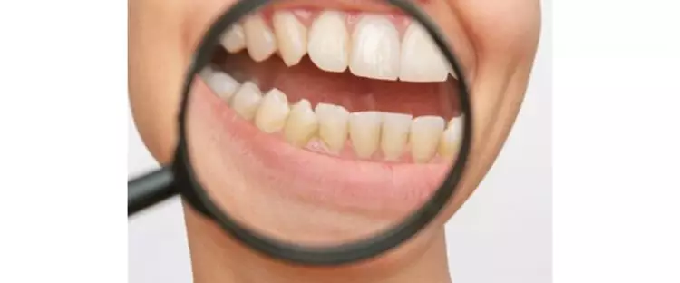 Cuma butuh 2 menit, ini trik agar gigi kuning &amp; bau jadi bersih total pakai 3 bahan dapur