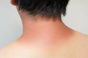 Tak cukup sabun biasa, ini cara putihkan kulit badan belang dan gelap pakai 1 produk olahan susu