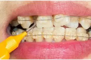 Hasil terlihat dalam 2 menit, ini cara optimalkan pasta gigi untuk pudarkan noda kuning pakai 1 daun