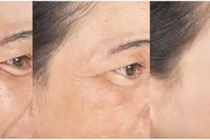 Kulit sehat bak remaja di usia kepala 4, ini trik kurangi wajah kendur berkerut pakai 1 jenis minuman