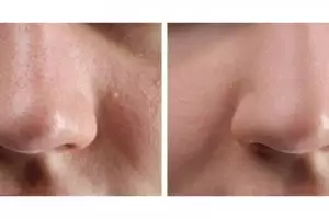 Tak cuma tepung beras, ini cara bikin pori-pori rapat dan bersih dari kotoran pakai 1 jenis minuman