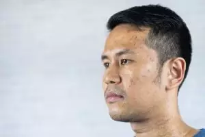 Tak perlu pil pemutih, ini trik hempas wajah kusam akibat flek dan daki pakai 1 jenis umbi-umbian