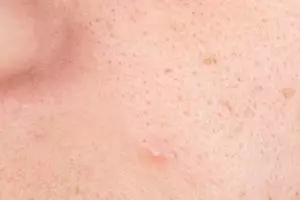 Nggak perlu scrub oatmeal, ini cara bersihkan dan kecilkan ukuran pori wajah pakai 1 penyedap masakan