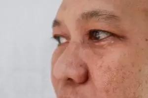 Hemat tanpa rutin ke klinik, ini cara pudarkan efek pigmentasi akibat penuaan pakai 1 jenis tepung