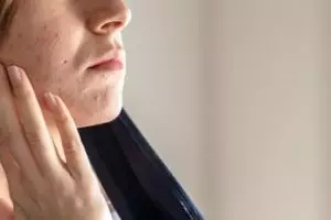 Tanpa air beras atau mawar, ini trik bikin pori-pori kecil dan tak tersumbat pakai 1 topping kue