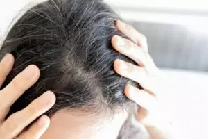 Tanpa pil suplemen, trik menutrisi rambut kering beruban agar kembali sehat pakai 1 jenis kulit buah