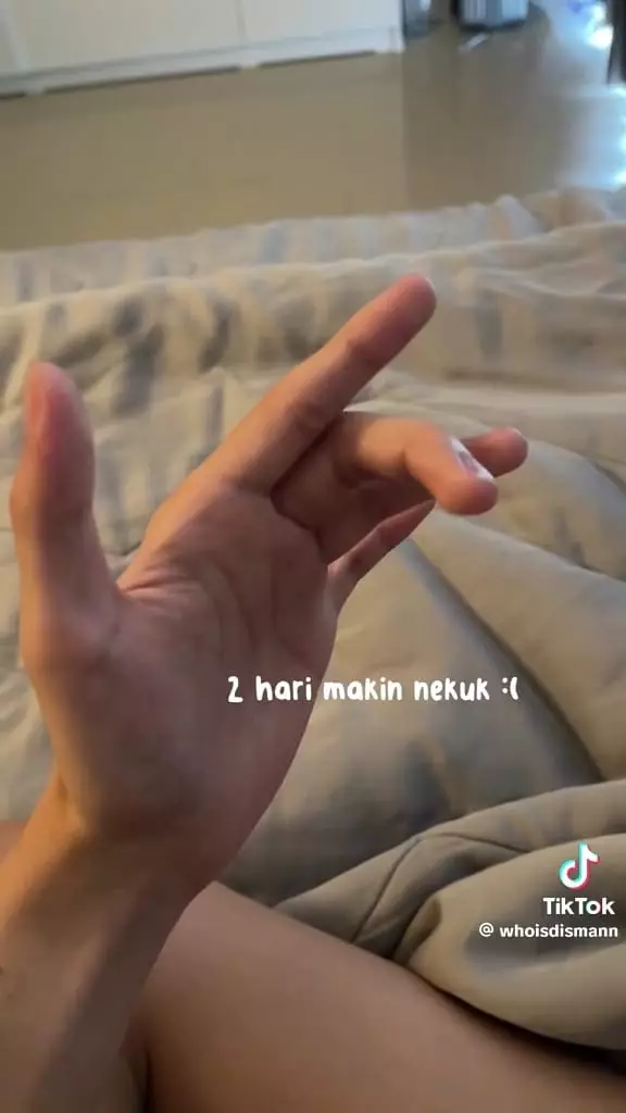 Jari dikira terkilir ternyata autoimun © TikTok