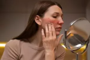 11 Skincare yang bagus dan aman untuk kulit sensitif merek lokal di bawah Rp 100 ribu, cegah iritasi