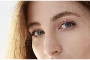 Tak gunakan kunyit, ini cara mencerahkan flek hitam di wajah pakai 1 bahan minuman