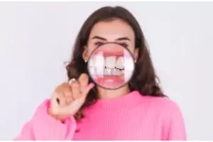 Tanpa obat kumur, ini trik rontokkan karang gigi dan hempaskan bau mulut tak sedap pakai 2 bahan dapur