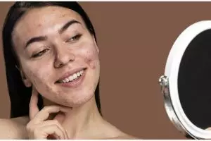 11 Rekomendasi skincare untuk bruntusan harga di bawah Rp 150 ribu, bikin wajah tampak halus kembali