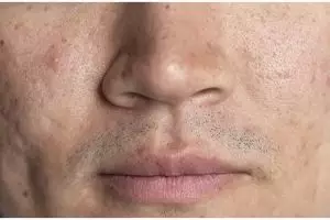 Tanpa scrub kopi, ini trik bikin pori-pori kulit wajah mengecil agar tampak halus pakai 1 jenis bubuk