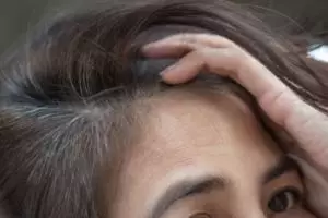 Hasilnya terlihat dalam semalam, ini cara atasi uban prematur agar kembali hitam pakai 1 jenis buah