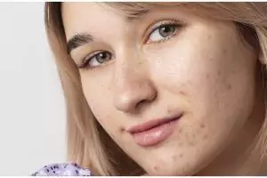 Tak dicampur kunyit, ini cara cerahkan pigmentasi akibat penuaan pakai masker dari 1 jenis rempah