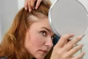 Tak perlu tambahan cengkeh, ini cara tumbuhkan rambut pitak di area dahi pakai 1 jenis pemanis alami